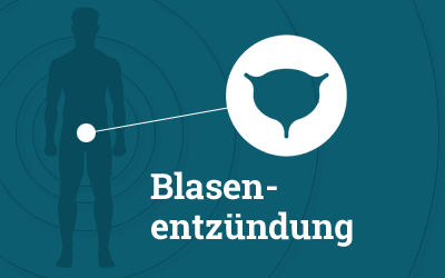 Blasenentzündung und Reizblase